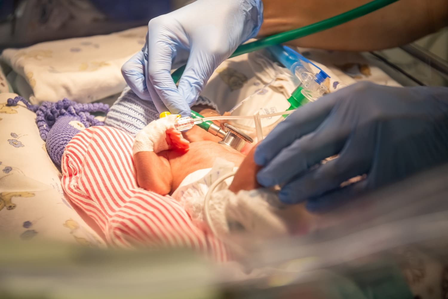 Выхаживание малышей с экстремально низкой массой тела