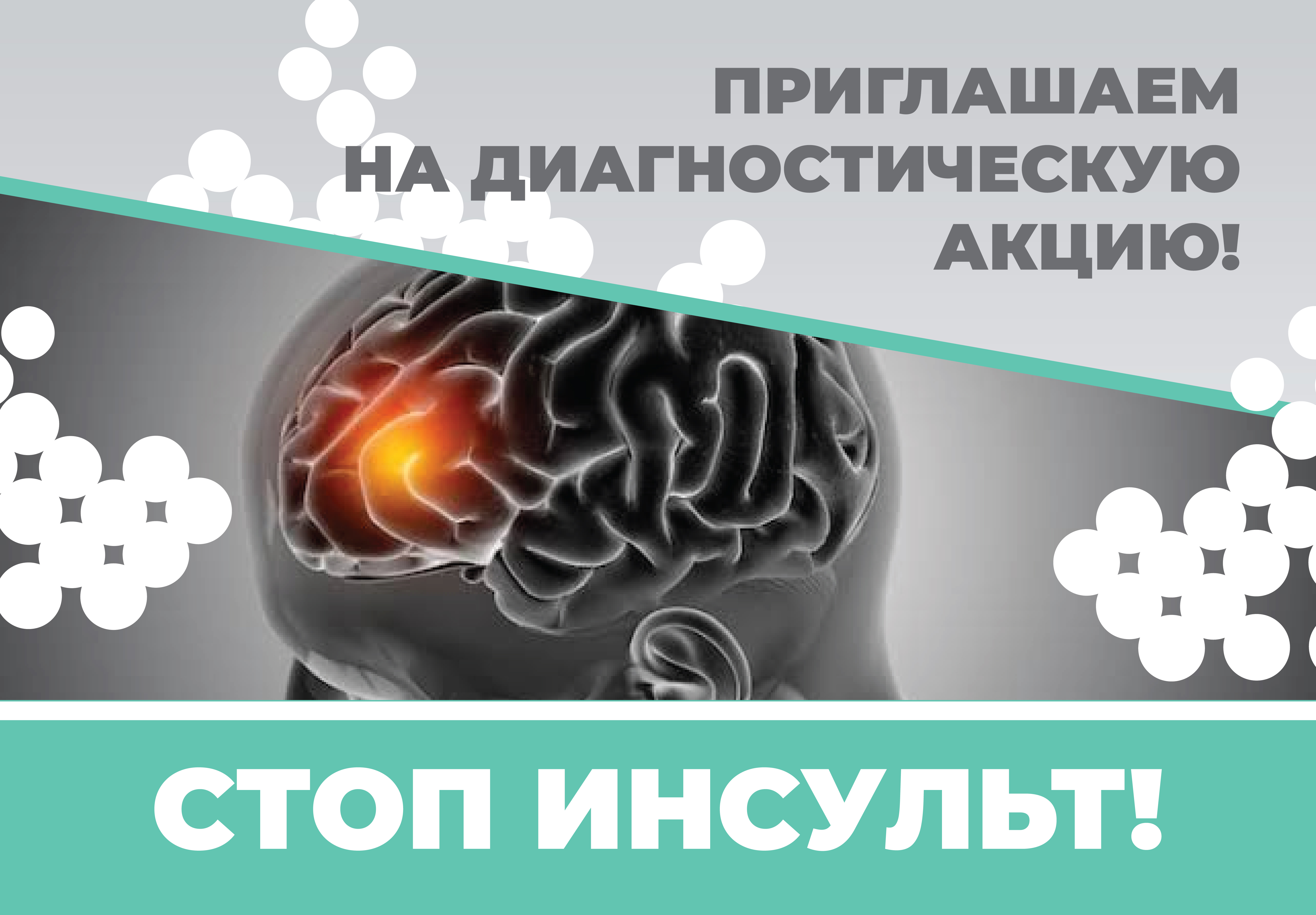 Инсульт молодеет. Успей сказать «Стоп!»